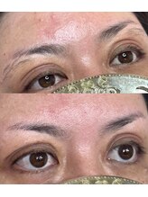 オランダエステティック(Holland Esthetics)/アイブロウBefore and After 