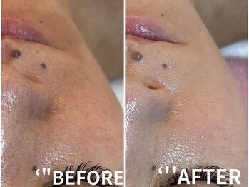 サロンパッテデシャット(salon patte de chat)/