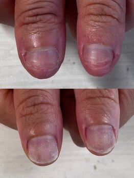 ヴェールリム(verl lim)/