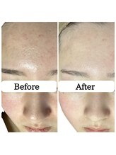 ル ボヌール/2回でこの結果◎