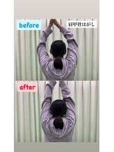 アスミルはり灸接骨院 金山駅前院/肩甲骨はがしで可動域改善へ