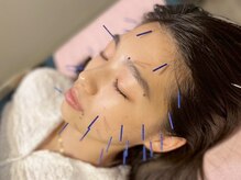 くわえ鍼灸整骨院