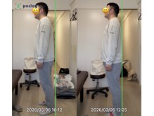 リプルズ(Ripples)/子供の抱っこで腰が痛い１