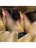 【後ろ姿まで抜かりなく★】うなじダブル脱毛（Wax＋光脱毛）