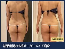 エヴァーグレース 川崎店/本格ヒップケアをすならEVER川崎