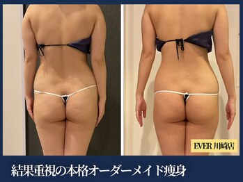エヴァーグレース 川崎店/本格ヒップケアをすならEVER川崎