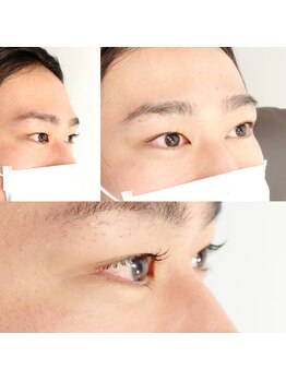 ミキ(MIKI)/【まつ毛パーマ】