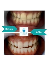 ティンクルホワイト 成田店/ビフォーアフター１