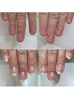 ミンスネイル(Mins Nail)/