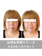 ガロシェ(galocher)/整顔筋膜リリース