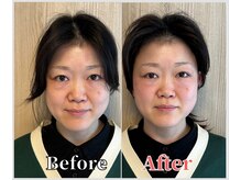 整体ラルース 中目黒(LALUZ)/40代 女性 頭蓋骨小顔矯正　変化