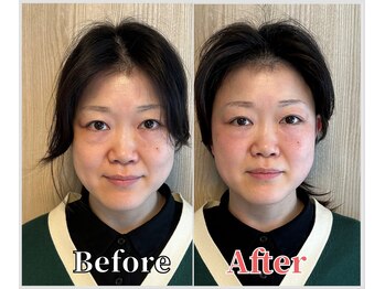 整体ラルース 中目黒(LALUZ)/40代 女性 頭蓋骨小顔矯正 変化