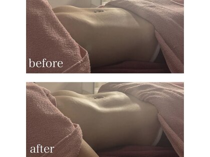 スノードロップ(snow drop)の写真