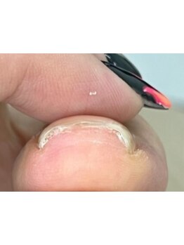 爪の悩みを解消できる（ケア含む）