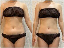 美容整体ウェリナ 中川八田院/小顔矯正/骨盤矯正/美脚サロン