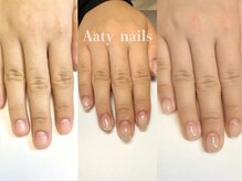 アーティネイルズ(Aaty Nails)/【深爪矯正】ハンド