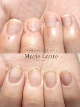 マリーロール 淀屋橋本店(Marie Laure)/自爪育成/深爪矯正/ネイルケア
