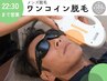 【メンズ☆大人気】ヒゲ脱毛（口周りのみ）　500円クーポン!!