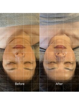 アンド ボナール(&-bonnard)/施術後Before/After