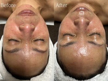 ルミナ シブヤ(LUMINA SHIBUYA)/【ダクトピール】1回目　正面