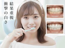 ダンブランシュサンダ(dents Blanches SANDA)