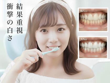 ダンブランシュサンダ(dents Blanches SANDA)の写真