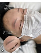 シツ(SHITSU)/症例【before・after】眉毛Wax