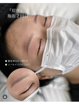 シツ(SHITSU)/症例【before・after】眉毛Wax