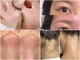 エトレ(ETOLE)の写真/【毛穴レスWAX】眉を整え顔全体のWAX◎産毛、角質を除去！ざらつきをケアし艶肌へ♪