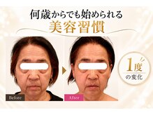 エン 橿原店(en)の雰囲気（小顔を目指すのは何歳からでもOK！綺麗に年齢制限はないのです♪）