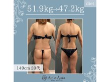 ボディエステティック アクアオーラ 高岡店/華奢な後ろ姿に♪