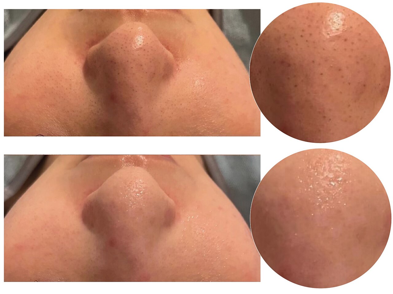 PB｜ホットペッパービューティー