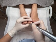 ドクターネイル爪革命 岐阜店/角質ケア