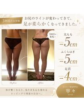 寧々/３回目ビフォアアフター