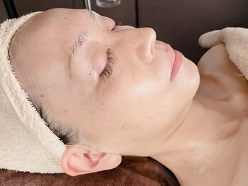 リフレ(Refre)/ハーブピーリング後は…艶々