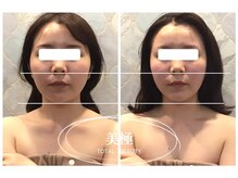 美極 銀座店/銀座/小顔コルギ/小顔矯正