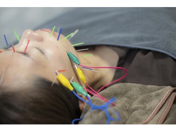 のぐち 石橋阪大前/【むくみスッキリ】美容鍼