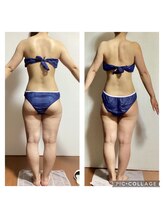 ビボディラボ 海老名店(美Body Labo)/20代★下半身痩せ