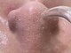 美痩身(bisoshin)の写真/【当店人気◎毛穴洗浄】毛穴の黒ずみ・角栓・角質・詰まりを徹底ケア！お肌の調子を整えます♪