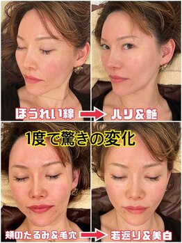 スペチアーレ 夙川/小顔と美肌が手に入る