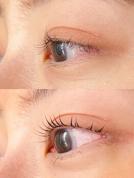 ミアン 名古屋(Mien)/before after