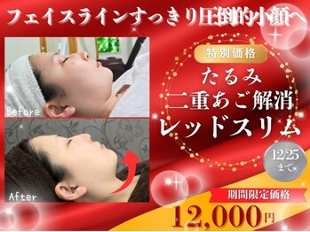 エステルーム ココ(COCO)