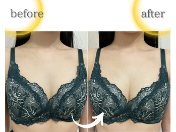 ラジュワード(lajward)/バストケア　before→after
