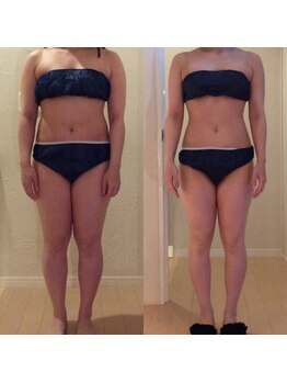 ホロニック ベルサンテ(Holonic Belle Sante)/メディセル