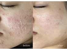 オリス 京都店(oliss)の雰囲気（当日からメイクOK！ヘアアイロンも貸し出ししています♪）