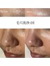 【毛穴、顔の産毛が気になる方に】毛穴洗浄+顏WAX