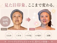 リコ 白金台(Liko)