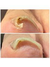 ミリアネイル 成城(Miliea nail)/