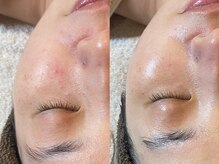 トトノエ(TOTONOE)/クリスティーナ-アンストレス-