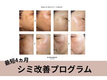 カンパニュラ(campanula)の雰囲気（「隠す肌」から「魅せる肌」へDr.PUR BEAUTE  毛穴・シミ・しわ）